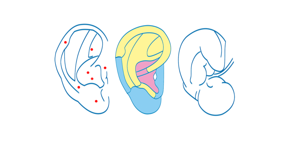 Partes de la oreja, auriculoterapia feto invertido